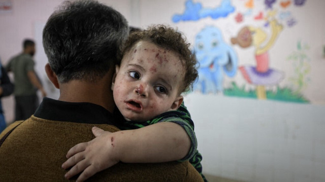 Le fils du caméraman palestinien Mohammed Alaloul, gravement blessé après une frappe israélienne sur le camp de réfugiés Al-Maghazi à Deir Balah dans le centre de la bande de Gaza, à l'hôpital al-Quds, le 5 novembre 2023. Crédit photo: MAHMUD HAMS / AFP
