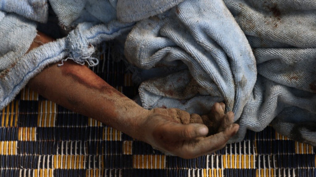 La main d'un Palestinien tué après une frappe aérienne israélienne sur des bâtiments à Rafah, dans le sud de la bande de Gaza, le 17 octobre 2023. Crédit photo: MOHAMMED ABED / AFP
