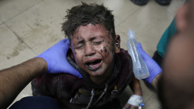 Un enfant palestinien gravement blessé par les frappes de l'armée d'occupation israélienne à al-Maghazi, à l'hôpital Al-Aqsa de Deir Balah, dans le centre de la bande de Gaza, le 11 décembre 2023.