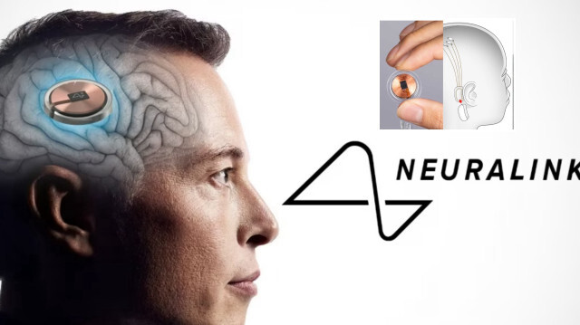 Musk'ın beyin çipi firması insan çalışması için onay aldı