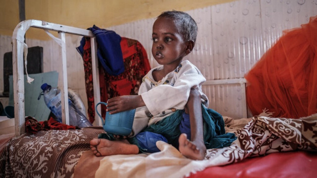 Abdullahi Higad Ali, 5 ans, à l'unité de nutrition de l'hôpital général de Gode, dans la ville de Gode, en Éthiopie, le 13 janvier 2023. Crédit photo: EDUARDO SOTERAS / AFP