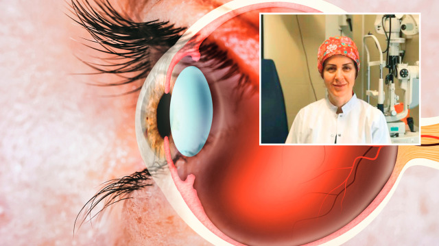 Göz Hastalıkları Ana Bilim Dalı Başkanı Prof. Dr. Banu Açıkalın