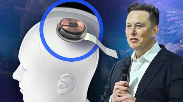 
Elon Musk, Neuralink'in beyin çipinin ilk kez bir insana yerleştirildiğini duyurdu