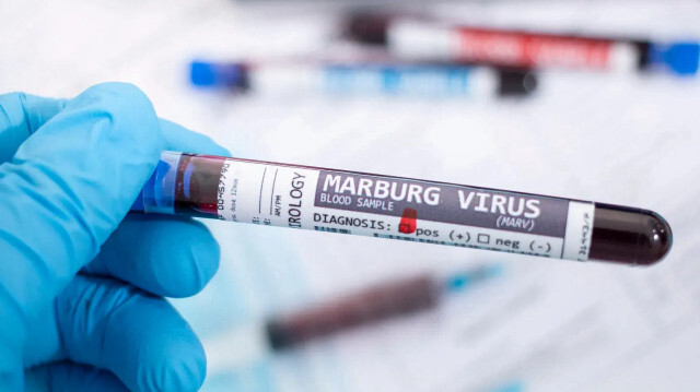 Le Rwanda a lancé le 6 octobre 2024 une campagne de vaccination expérimentale contre le virus de Marburg, une fièvre hémorragique mortelle apparentée à Ebola. Les autorités ont signalé 41 cas et instauré des mesures pour limiter la propagation.