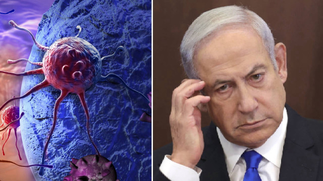 Gazze'de binlerce insanı katlettiren Netanyahu kanser oldu