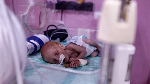 Les bébés prématurés risquent une mort imminente en raison des attaques israéliennes contre les hôpitaux dans la bande de Gaza.