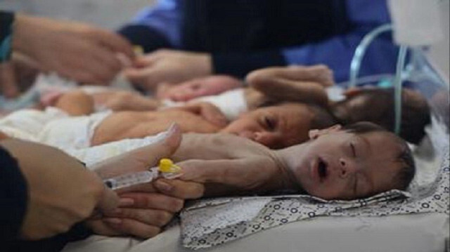وفاة جديدة لطفل ترفع ضحايا الجوع في غزة إلى 30 
