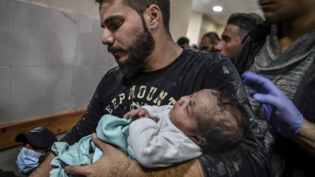 Gazze'de bebekler açlık nedeniyle hayatını kaybediyor (Foto: Arşiv)