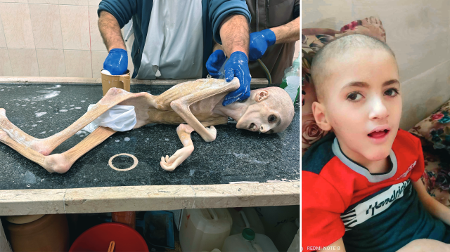 İsrail ablukası nedeniyle açlıktan ölen Yezen'in defnedilmeden önceki görüntüsü / 10 yaşındaki Yezen'in 8 ay ay önceki sağlıklı halinden fotoğrafı.