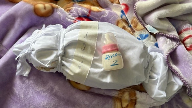 Le corps enveloppé d'un bébé palestinien mort de malnutrition et de manque d'eau, dans l'unité de soins intensifs de l'hôpital Kemal Adwan à Beit Lahiya dans la bande de Gaza le 01 mars 2024.