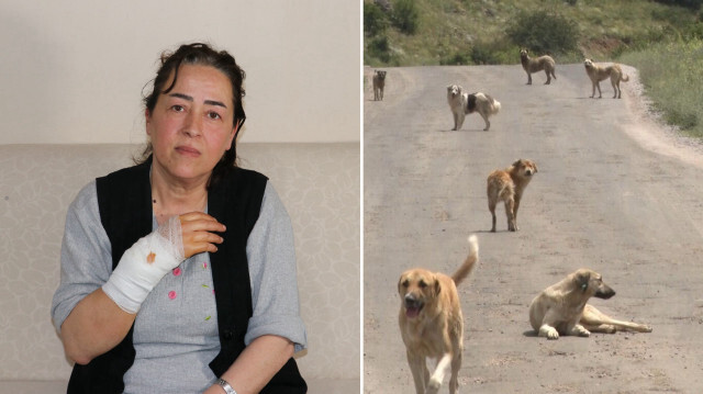 Köpek saldırısında yaralanan kadın yaşadığı korku dolu anları unutamıyor
