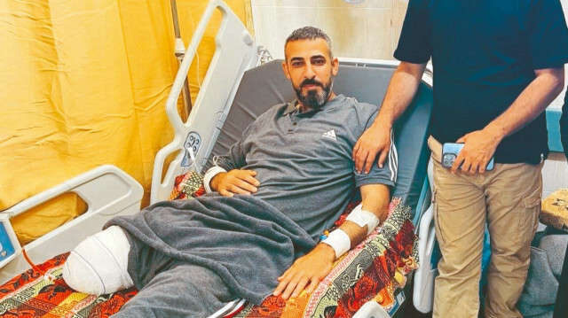 Kameraman Sami Şahade İsrail saldırında bir bacağını kaybetti.