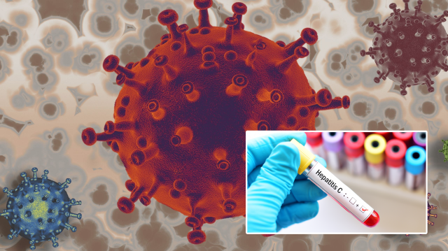 DSÖ açıkladı: Hepatit B ve C enfeksiyonlarından her gün 3 bin 500 kişi ölüyor