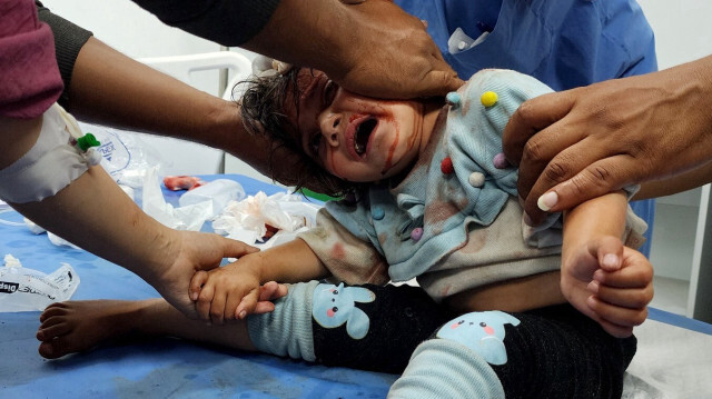 صحة غزة: لا يوجد مستشفى برفح يستوعب ضحايا مجزرة الاحتلال