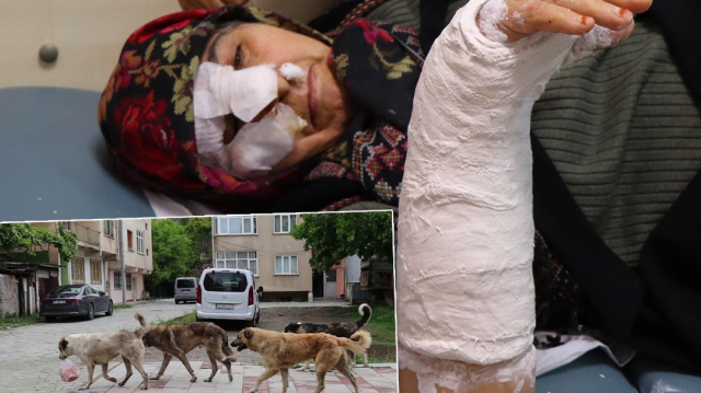 Saldıran sokak köpeklerinden kurtulmaya çalışırken merdivenlerden düşen kadının burnu ve kolu kırıldı.