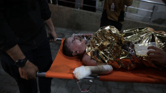 Un enfant sur une civière est vu alors que les blessés sont transférés à l'hôpital de Koweït après une attaque d'artillerie menée par l'armée israélienne sur la ville de Rafah dans le sud de la bande de Gaza le 08 mai 2024.