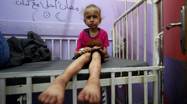 Une petite fille palestinienne traumatisée par les attaques de l'armée israélienne attend d'être soigné à l'hôpital des Martyrs d'Al-Aqsa à Deir al-Balah, dans le centre de la bande de Gaza, en Palestine, le 30 mai 2024.