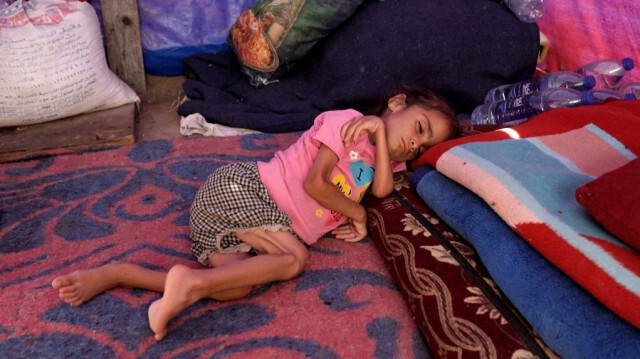 Hana Abdelrahaman al-Rai, une petite fille de quatre ans souffrant de malnutrition et déplacée de force en raison des attaques de l'armée d'occupation israélienne, de la banlieue Est de Gaza, Shujaiya, à l'intérieur d'une tente à Zawayda, dans le centre de la bande de Gaza, en Palestine, le 4 juin 2024.