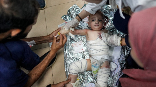 Des médecins s'occupent d'un enfant Palestinien en bas âge gravement blessé à la suite d'un bombardement israélien sur al-Bureij dans un service de l'hôpital des Martyrs d'Aqsa à Deir el-Balah, dans le centre de Gaza, en Palestine, le 4 juin 2024.