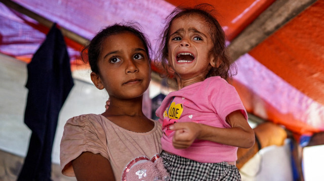 Hana Abdelrahaman al-Rai, une enfant de quatre ans souffrant de malnutrition et déplacée de la banlieue est de la ville de Gaza de Shujaiya, réagit alors qu'elle est transportée à l'intérieur d'une tente à Zawayda dans le centre de la bande de Gaza le 4 juin 2024, dans le cadre du conflit en cours dans le territoire palestinien entre Israël et le Hamas.