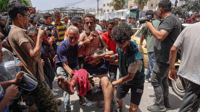 Un homme blessé est transporté à l'hôpital des Martyrs d'al-Aqsa à Deir al-Balah, dans le centre de la bande de Gaza, après le bombardement israélien d'un appartement résidentiel à Deir al-Balah et d'une zone d'al-Maghazi, le 8 juin 2024, dans le cadre du conflit actuel entre Israël et le groupe militant palestinien Hamas.