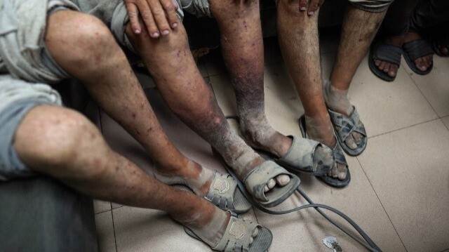 Des prisonniers palestiniens après leur libération, à l'hôpital des martyrs d'Al-Aqsa à Deir al-Balah, dans la bande de Gaza centrale, le 1er juillet 2024.
