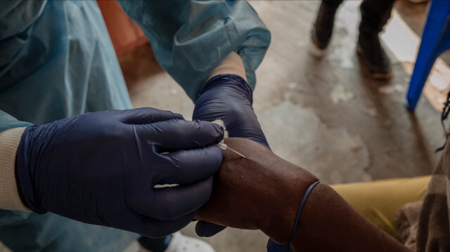 Un agent de santé prélève un échantillon au centre de traitement Mpox de l'hôpital général de référence Nyiragongo, au nord de la ville de Goma en République démocratique du Congo, le 16 août 2024. L'agence des Nations unies pour la santé s'inquiète de l'augmentation du nombre de cas et de décès en République démocratique du Congo et de la propagation au Burundi, au Kenya, au Rwanda et à l'Ouganda.