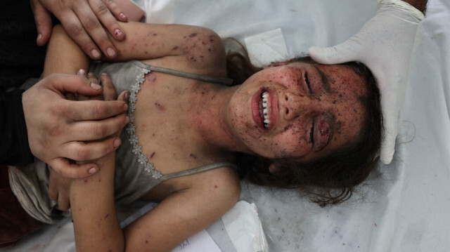 Une petite fille palestinienne tient la main d'un proche pendant qu'un médecin soigne ses blessures causées par les bombardements de l'armée d'occupation israélienne, dans un hôpital à Rafah, au sud de la bande de Gaza.