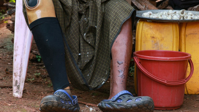 Le fermier Hla Han, 52 ans, qui a perdu sa jambe après avoir marché sur une mine, en train d'éplucher de l'ail devant sa maison dans la commune de Demoso, dans l'est de l'État de Kayah, le 18 novembre 2024.