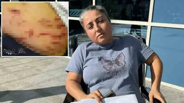 Sokak ortasında cins köpeğin saldırına uğradı