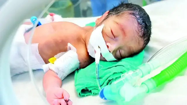 Gazze’de soykırım sonucu abluka ve açlık, yeni doğan her on bebekten yedisini prematüre ya da düşük kilolu bırakıyor.