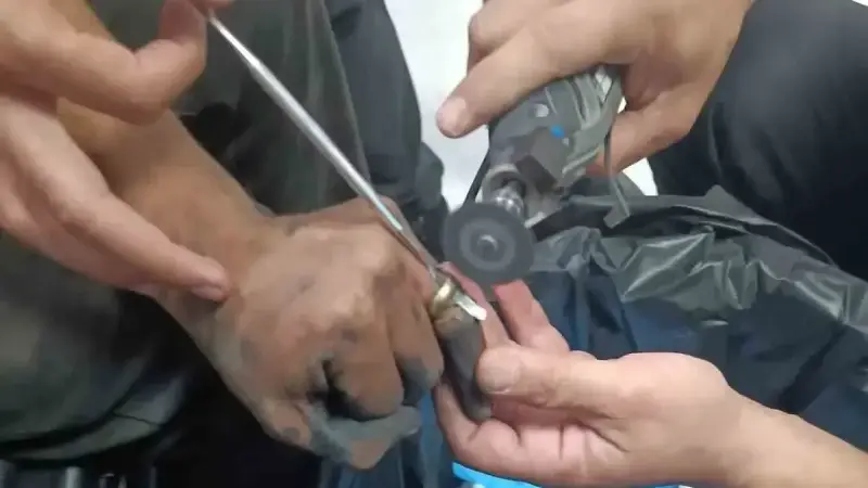 Yüzük itfaiye erlerinin müdahalesiyle çıkartılamayınca, doktor gözetiminde çıkartıldı.
