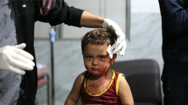 Un enfant blessé lors d'une attaque menée par Israël contre le camp de réfugiés de Nuseirat, en violation du cessez-le-feu, est transporté à l'hôpital Al-Awda de Gaza City, Gaza, le 29 octobre 2025. Selon les médecins, des dizaines de Palestiniens ont été blessés lors de frappes aériennes contre des cibles civiles à l'intérieur de la "ligne jaune".