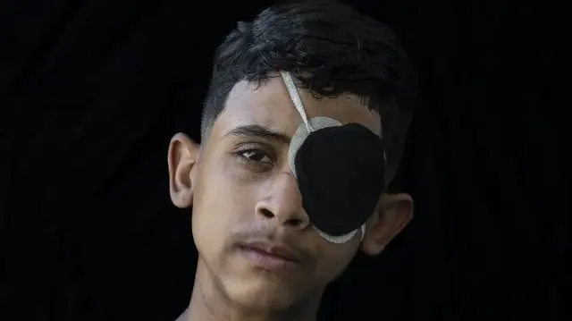 <p>مخلفات عامين من الإبادة.. الطفولة بغزة تنزف يُتما وإعاقة</p>