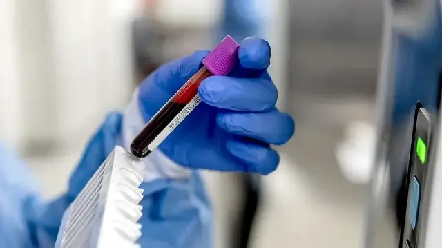 Scientists Develop First Accurate Blood Test for Chronic Fatigue Syndrome