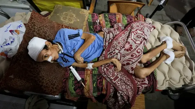 Gaza Famine: A Deliberate Strategy of Starvation as Warfare