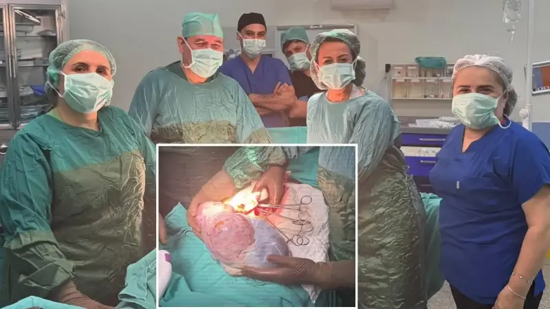 Ordu'da hastanın karnından 5 kiloluk kitle çıkarıldı