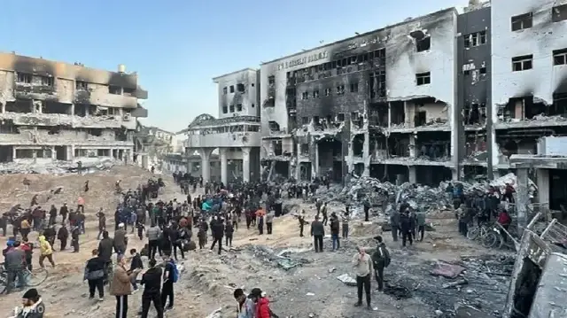 صحة غزة: تسجيل 6 آلاف حالة بتر جراء الإبادة الإسرائيلية خلال عامين 
