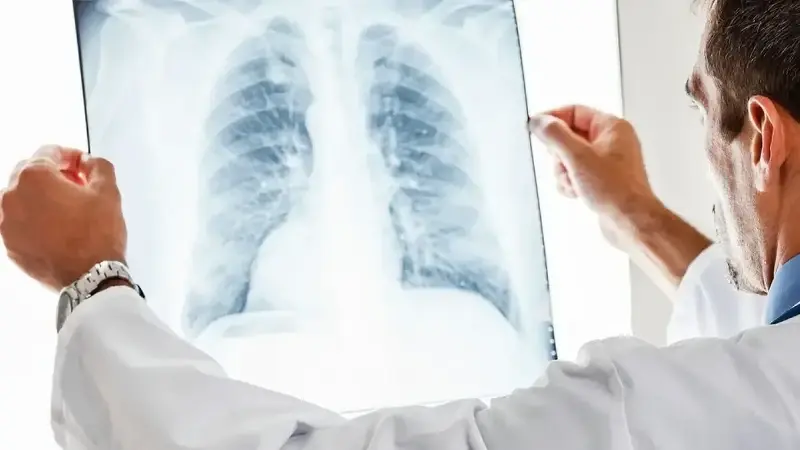 Zatürre risk gruplarında belirti olmadan seyredebilir