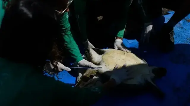 Polish surgeons remove 35-pound tumor initially misdiagnosed