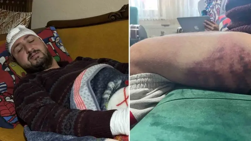 Yüzde 85 otizmli ve epilepsi hastası Ertuğrul Şenol