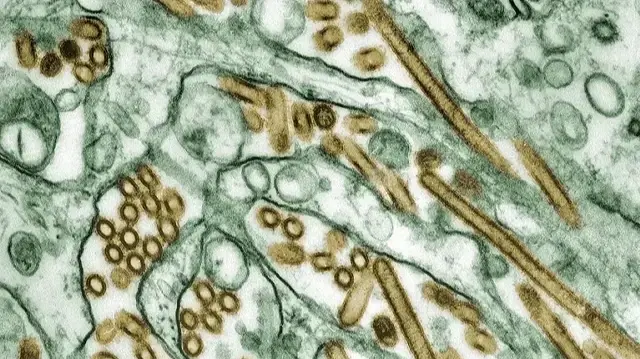 В США первый случай заражения человека вирусом H5N5