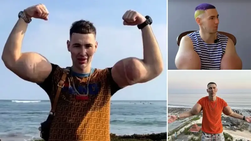 'Rus Temel Reis' kollarını kaybetmek üzere