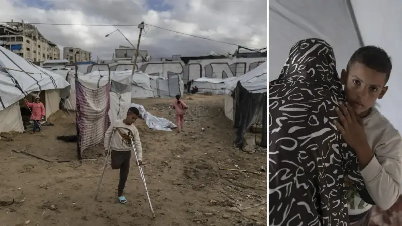 İsrail saldırısında bir bacağını kaybeden Filistinli çocuk ailesinin yardımıyla yaşama tutunuyor