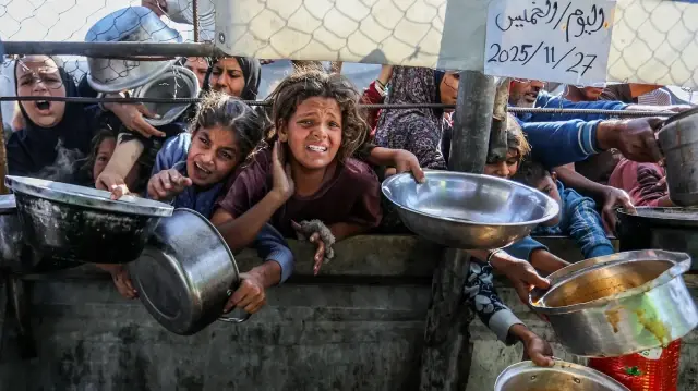 UNICEF: Nearly 9,300 Gaza children under five face severe malnutrition