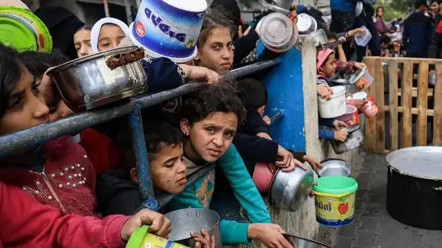  9 آلاف طفل دون 5 سنوات في غزة يعانون سوء تغذية حاد