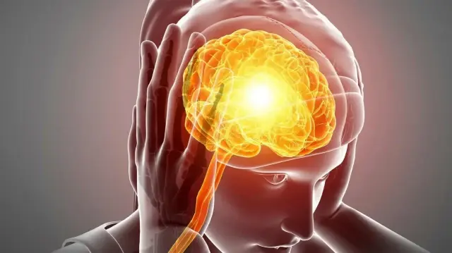 Headache disorders affect over 2.8 billion people globally: study