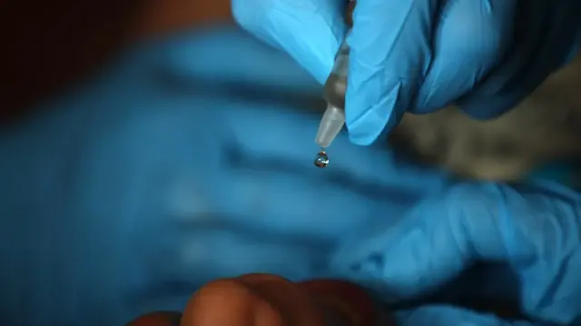 Un enfant palestinien reçoit un vaccin contre la polio dans un centre de santé des Nations Unies à Deir Al-Balah, dans le centre de la bande de Gaza, le 1er septembre 2024.