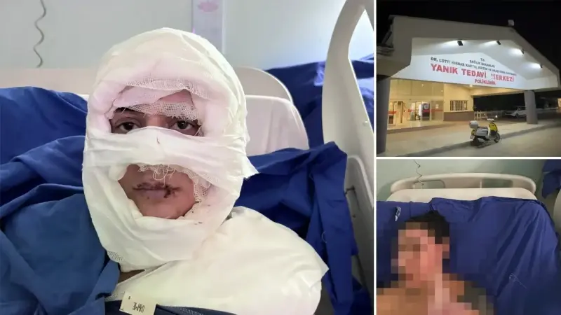 Gözde Yılmaz'ın tedavisi devam ediyor