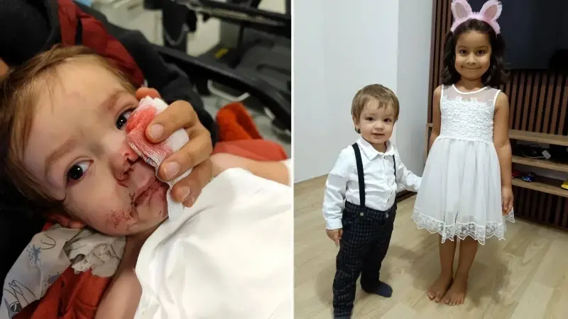 2 kardeşe saldıran pitbull ve sahibi yakalandı